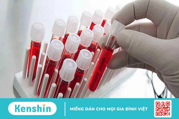 Góc giải đáp: Xét nghiệm canxi máu có lợi ích gì? 1