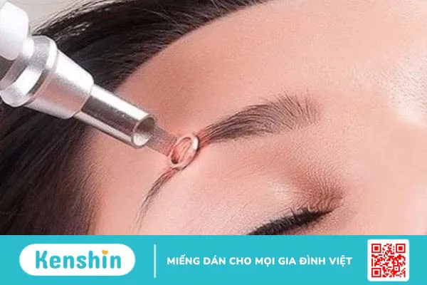 Hậu quả điêu khắc lông mày kém chất lượng và cách khắc phục