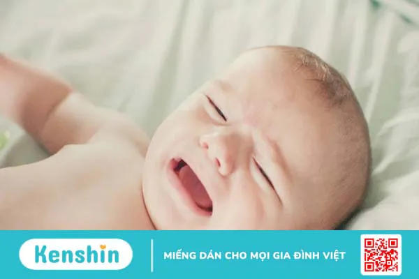 Hẹp đường mật bẩm sinh: Nguyên nhân, triệu chứng và cách điều trị 1