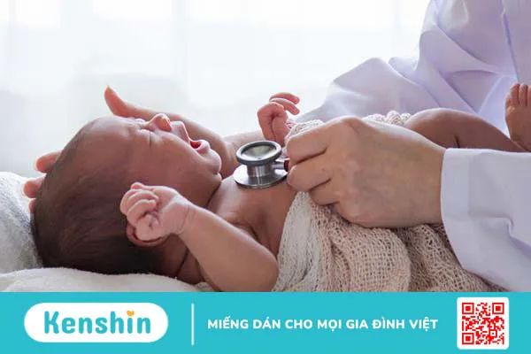 Hẹp đường mật bẩm sinh: Nguyên nhân, triệu chứng và cách điều trị 3