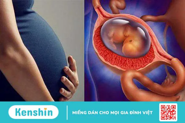 Hiện tượng bóc tách túi thai ảnh hưởng đến mẹ và bé như thế nào? 1