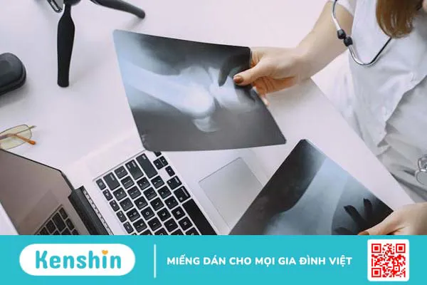 Hiểu rõ về viêm màng hoạt dịch thể lông nốt sắc tố 2