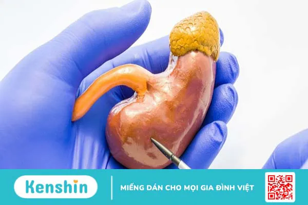 Hội chứng Conn: Nguyên nhân, triệu chứng, cách chẩn đoán và điều trị 1