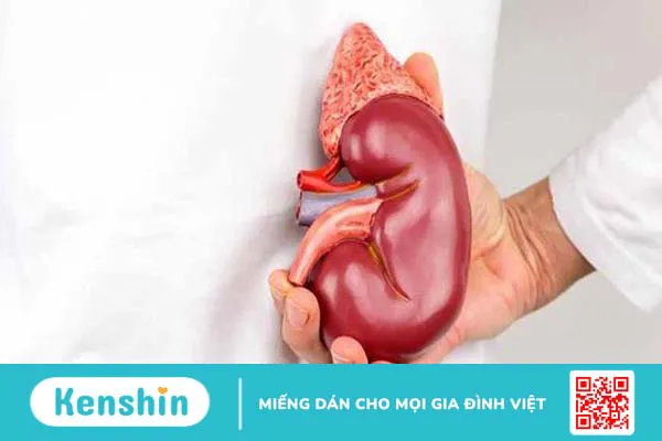 Hội chứng Conn: Nguyên nhân, triệu chứng, cách chẩn đoán và điều trị 3