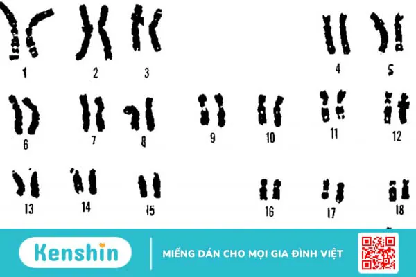 Hội chứng không nhạy cảm androgen là gì 1