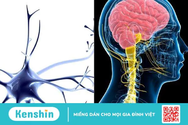 Nguyên nhân và biểu hiện của hội chứng Parkinson thứ phát và không điển hình 4