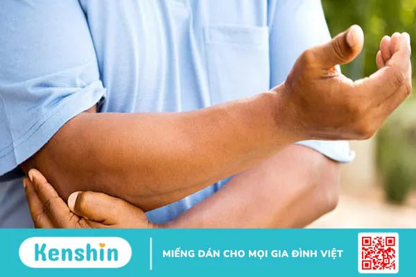 Đau lan dọc theo bên ngoài cánh tay thường là biểu hiện của hội chứng rễ thần kinh chi trên