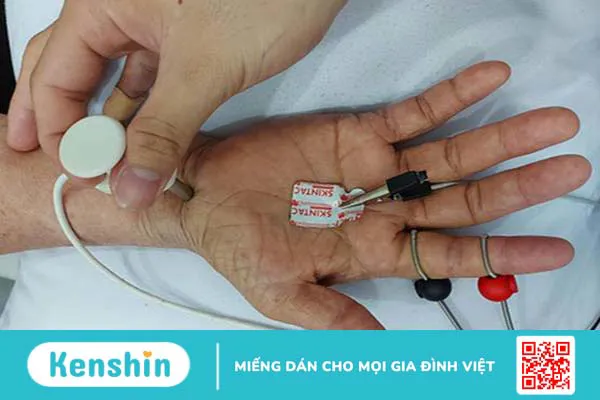 Hội chứng sau bại liệt: Dấu hiệu và cách khắc phục 4