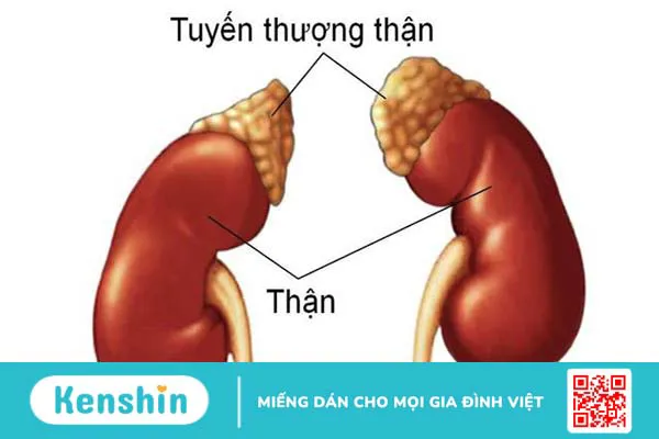 Hội chứng sinh dục thượng thận là gì? Nguyên nhân và cách điều trị 1