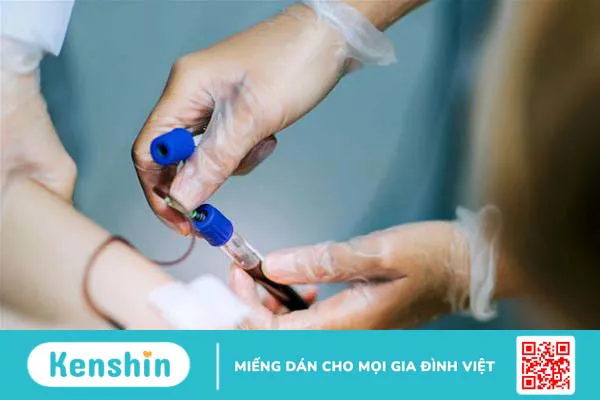 Hội chứng Wiskott-Aldrich - Hiếm gặp nhưng rất nguy hiểm 4