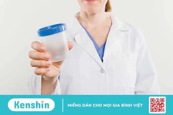 Hướng dẫn cách lấy nước tiểu đúng cách để xét nghiệm nước tiểu 1