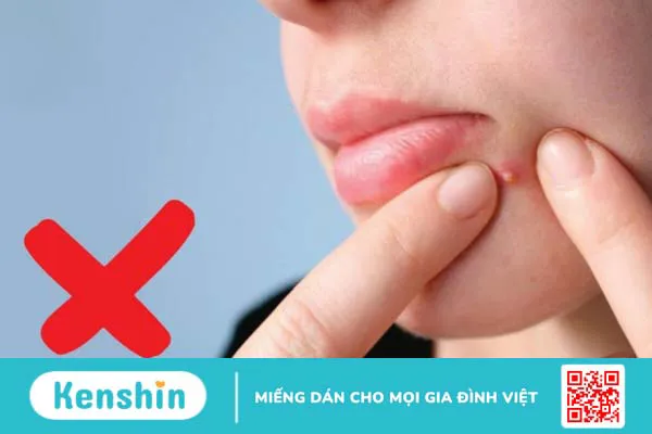 Hướng dẫn cách trị mụn đầu đinh dân gian đơn giản tại nhà