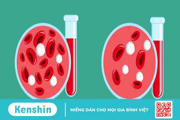 Hướng dẫn chăm sóc bệnh nhân thiếu máu 1