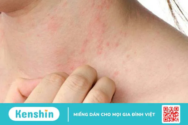 Hướng dẫn chăm sóc da cho mẹ bầu đầy đủ nhất 2