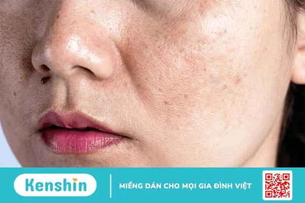 Hướng dẫn chăm sóc da cho mẹ bầu đầy đủ nhất 3