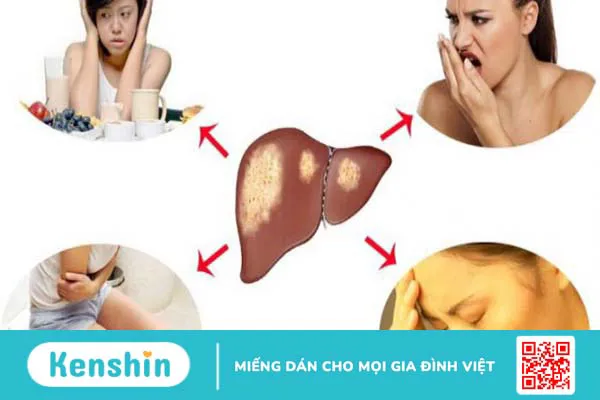 Khi nào cần thải độc gan? Mách bạn cách thải độc gan tại nhà 3