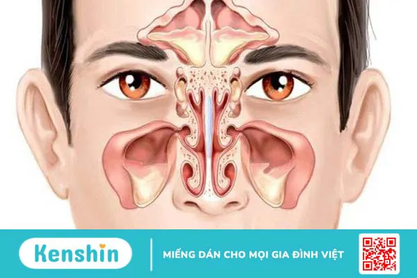 Khứu giác là gì? Những bệnh lý nào ảnh hưởng đến khứu giác? 2