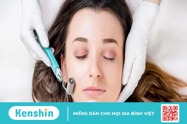 Lăn kim siêu vi điểm - Ưu và nhược điểm mà bạn cần biết 1