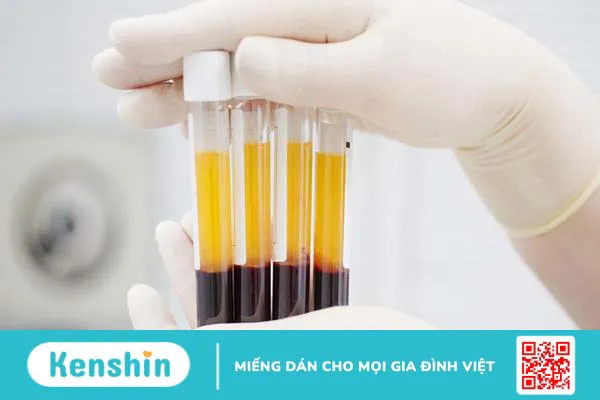 Liệu pháp PRP là gì? Cách thực hiện và đối tượng được chỉ định 3