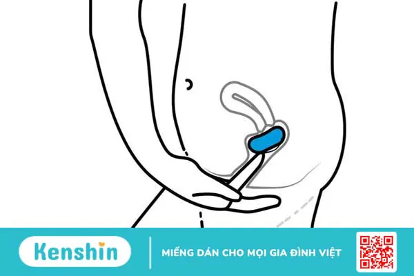 Màng phim tránh thai có tác dụng phòng tránh thai