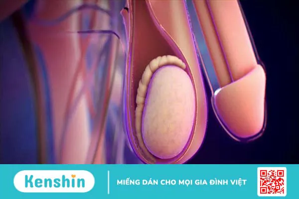 Mào tinh hoàn là gì? Các bệnh lý thường gặp ở mào tinh hoàn 1