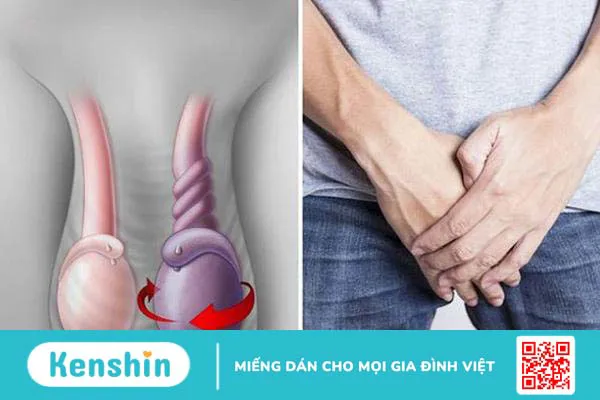 Mào tinh hoàn là gì? Các bệnh lý thường gặp ở mào tinh hoàn 4