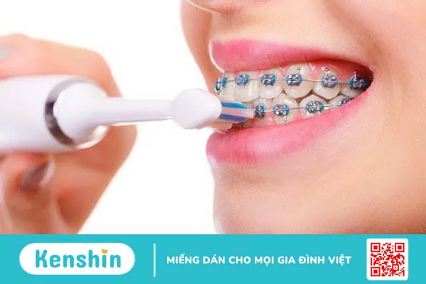 Máy tăm nước rất phù hợp với người niềng răng