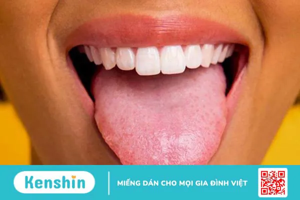 Miệng có vị kim loại gây nguy hiểm không? Nguyên nhân do đâu và cách phòng ngừa 1