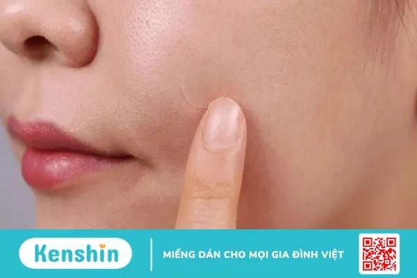 Miếng dán hút mụn ngày và đêm Derma Angel có tốt không? 2