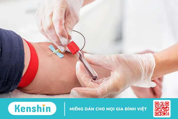 Mỡ máu gia đình: Dấu hiệu nhận biết, phương pháp chẩn đoán và hướng điều trị 3