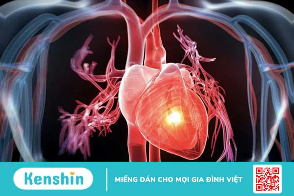 Mổ nội soi cắt hạch thần kinh giao cảm như thế nào để đảm bảo an toàn 4