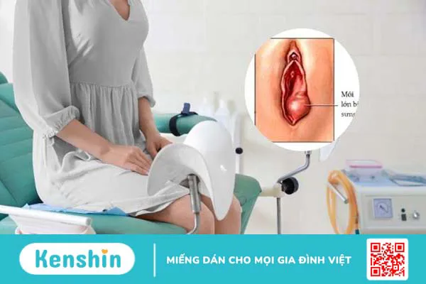 Môi âm hộ và những thông tin phái đẹp nên biết 3