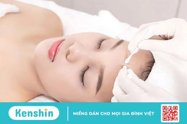 Góc giải đáp: Nặn mụn xong có nên rửa mặt không? 1