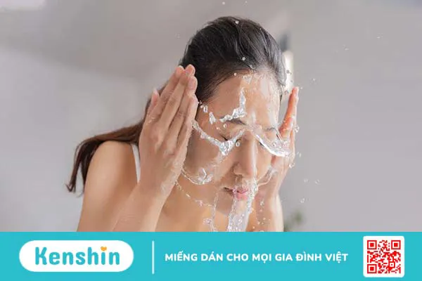 Góc giải đáp: Nặn mụn xong có nên rửa mặt không? 2