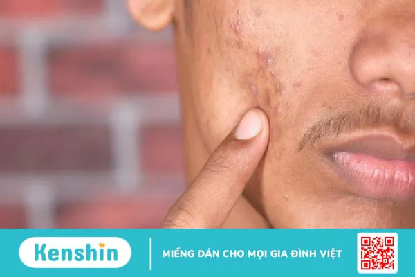 Nên bôi Derma forte bao lâu thì bôi kem chống nắng để đạt hiệu quả sử dụng tốt nhất? 2