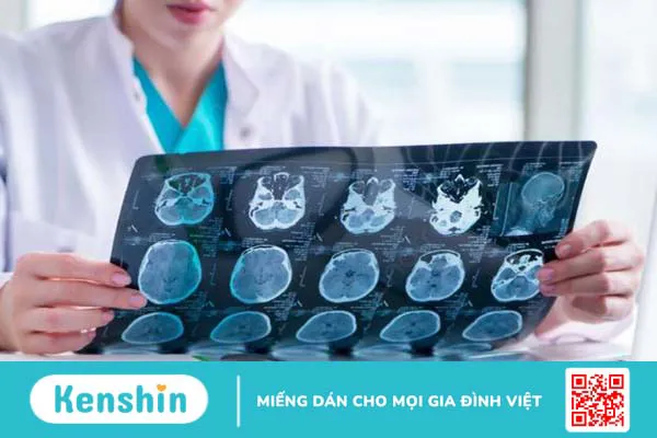 Nên khám chóng mặt ở đâu? Nguyên nhân và biện pháp điều trị chóng mặt hiệu quả 2