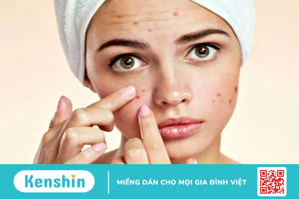 Nên lấy nhân mụn bao lâu một lần