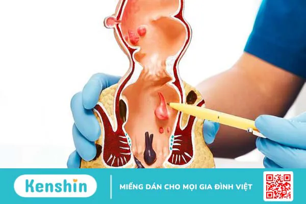 Nên uống bột diếp cá vào lúc nào để đạt hiệu quả tốt nhất? 1