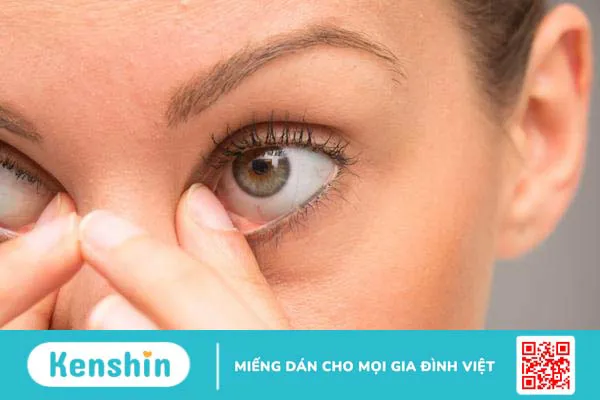 Nếp nhăn dưới mắt: Bật mí các phương pháp cải thiện hiệu quả 2