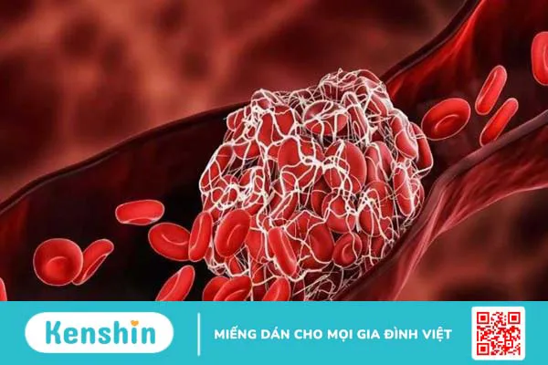 Giải đáp: Nghệ đen có tác dụng gì? Những điều cần biết trước khi sử dụng 4