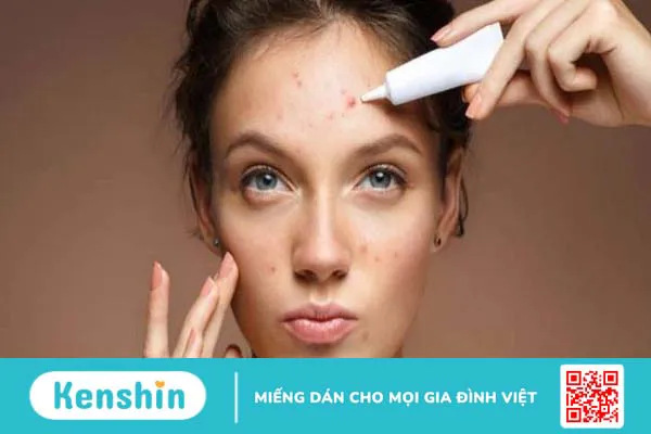 Nguyên nhân gây mụn bọc ở trán và cách điều trị 3