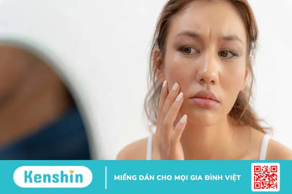 Nguyên nhân khiến da xỉn màu và cách cải thiện hiệu quả 1