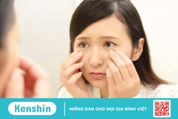 Nguyên nhân và cách chữa lòng trắng mắt bị vàng 3