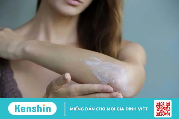 Nguyên nhân và cách điều trị khi bị ngứa toàn thân 4