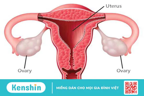 Cảm giác đau tại buồng trứng, nguyên nhân và cách điều trị 1