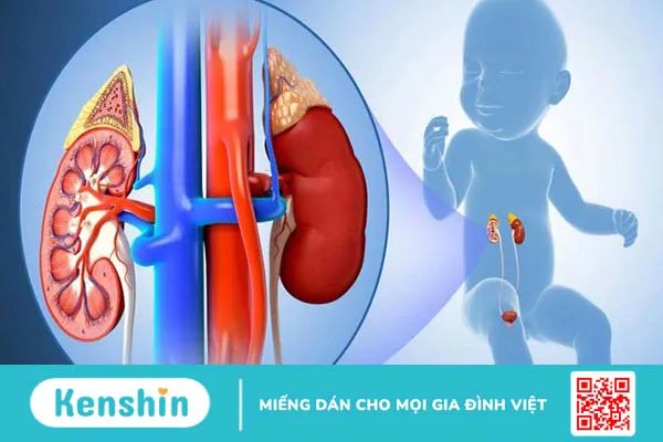 Nhận biết những dạng viêm cầu thận thường gặp 1