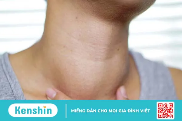 Nhân tuyến giáp có nguy hiểm không? 3