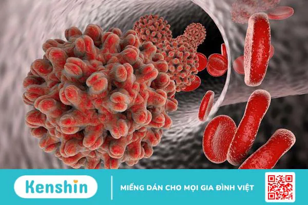 Nhiễm trùng máu do virus: Nguyên nhân, triệu chứng và mức độ nguy hiểm 1