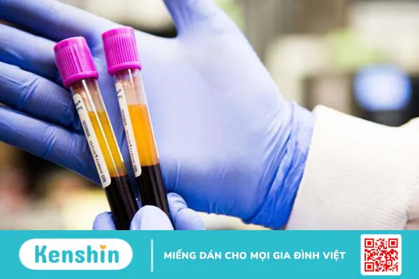 Nhiễm trùng máu do virus: Nguyên nhân, triệu chứng và mức độ nguy hiểm 3