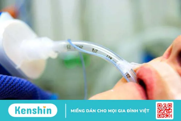 Những biến chứng sau khi rút nội khí quản và cách xử trí 1